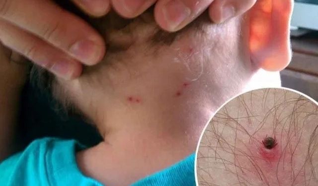 FALLECE ESTUDIANTE POR PIQUETE DE GARRAPATA